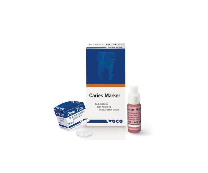 Kariesdiagnostik