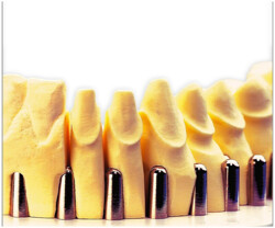 HinriMill e4 e5 Fräser